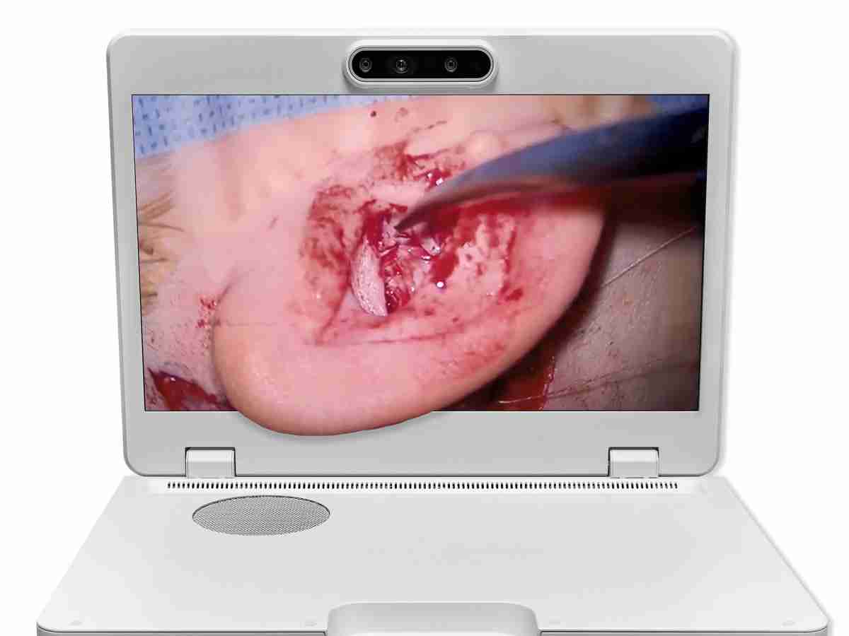 达擎之＂Heads-up 3D显微手术显示系统＂，，，整合4K裸眼3D显示及眼球追踪系统，，具备快速追踪人眼移动位置功能，，减轻医师长时间维持固定姿势的负担，，，，让医师能有更宽广清晰的3D立体视野及更舒适的姿势来执行手术。。